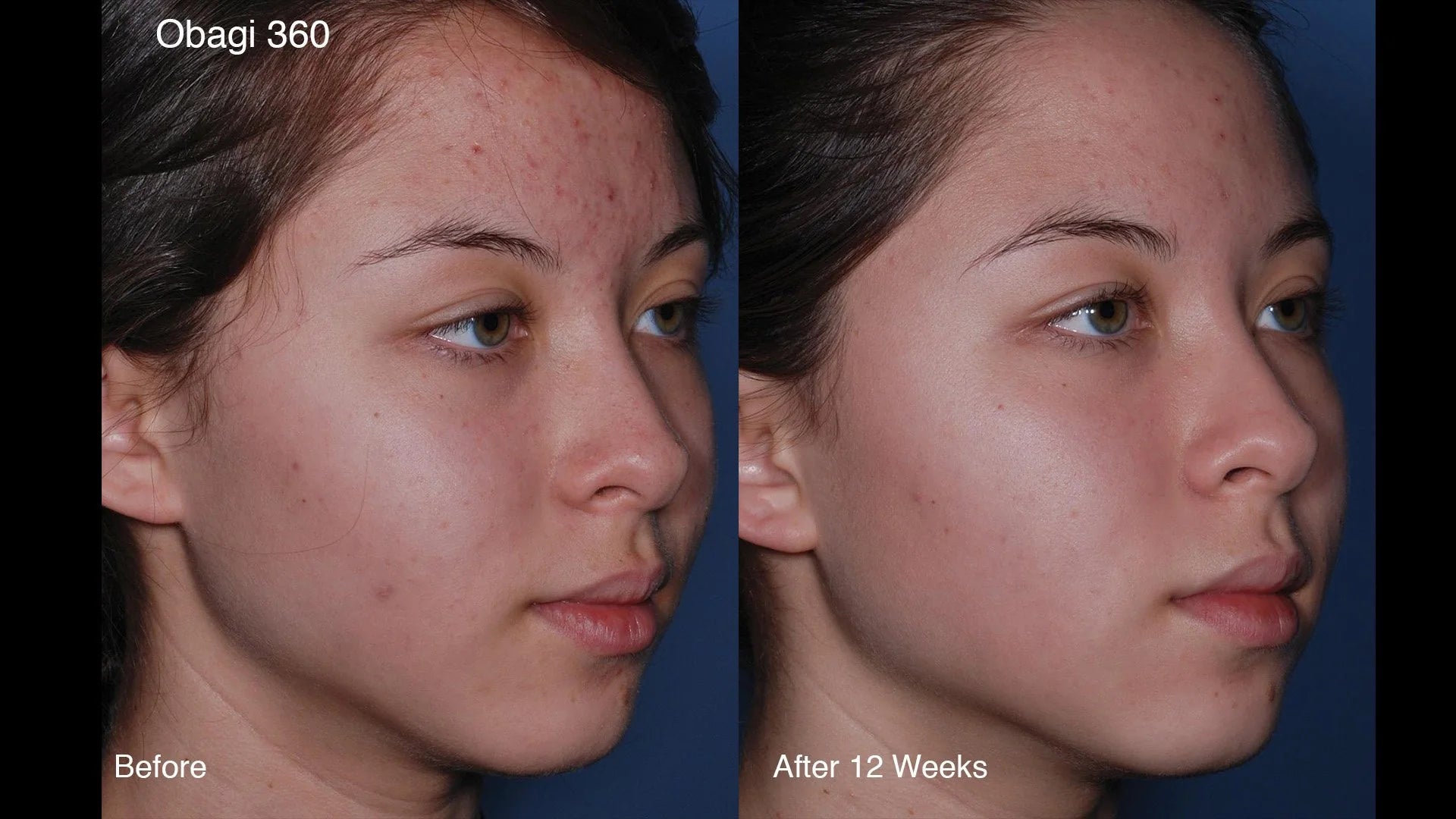 CLENZIderm Daily Foaming Cleanser