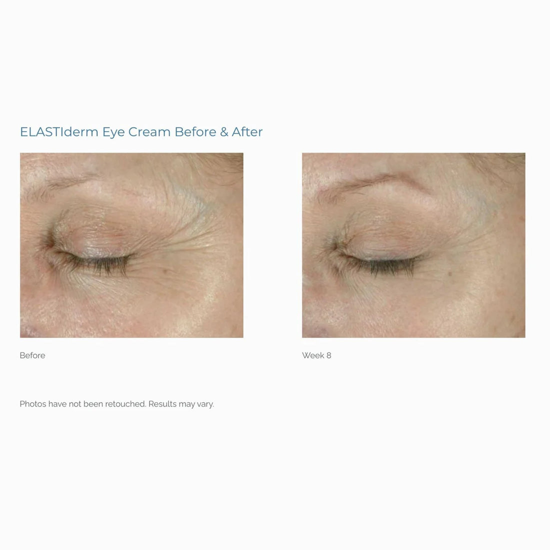 ELASTIderm Eye Cream