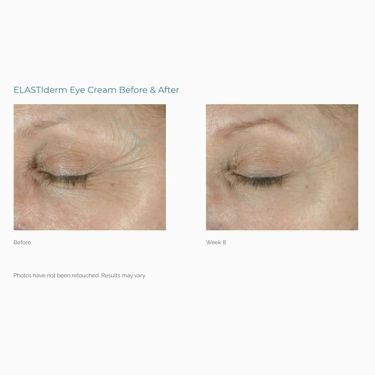 ELASTIderm Eye Cream