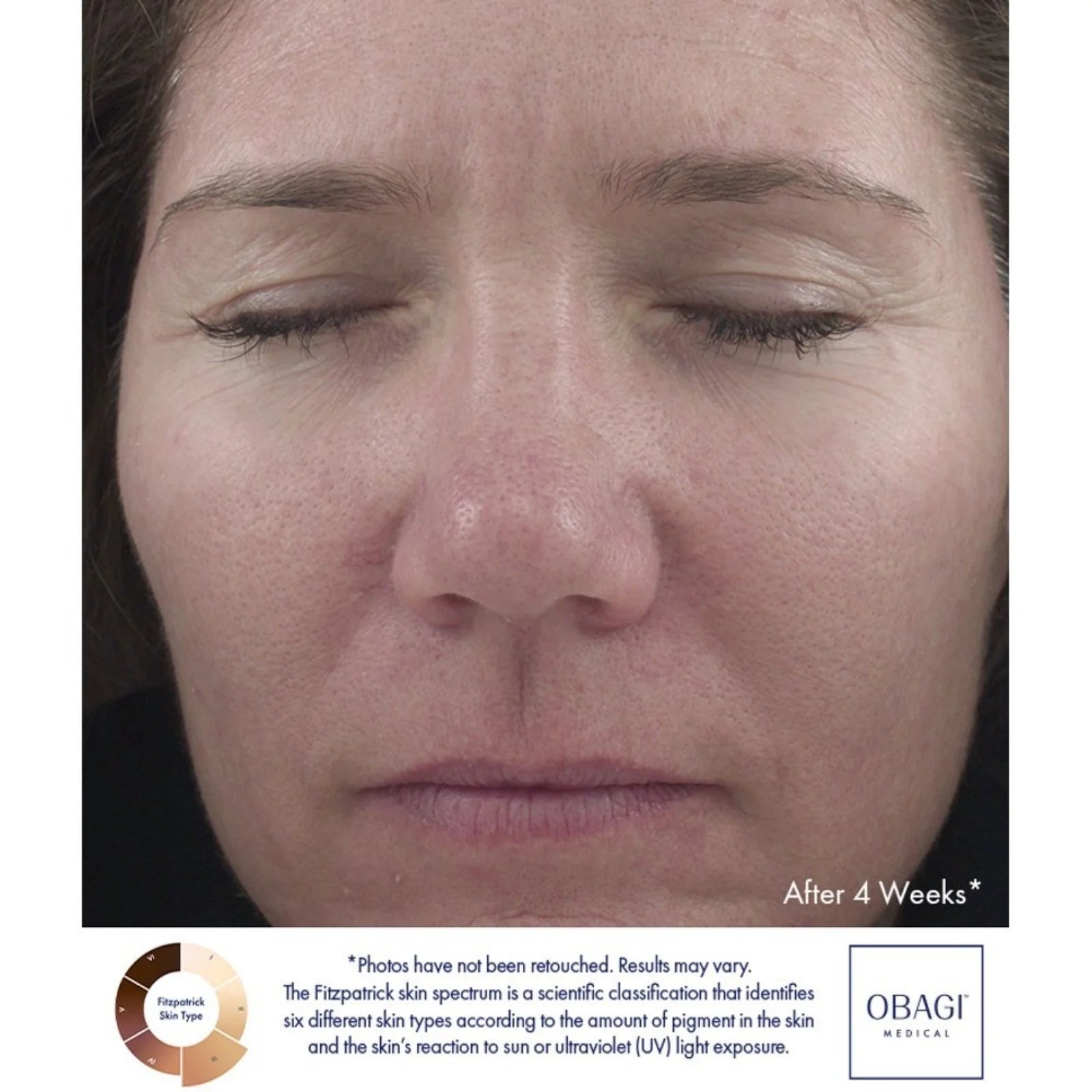 Retinol 1.0 Cream
