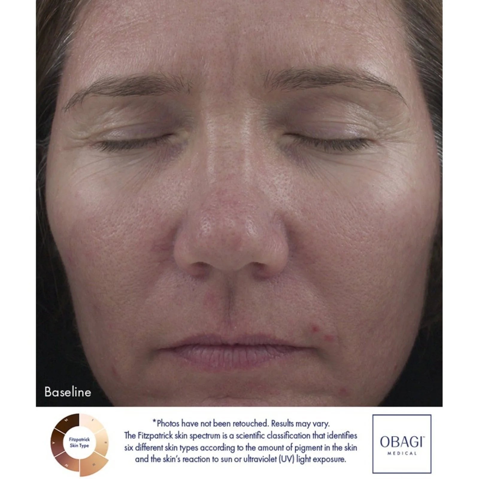 Retinol 1.0 Cream