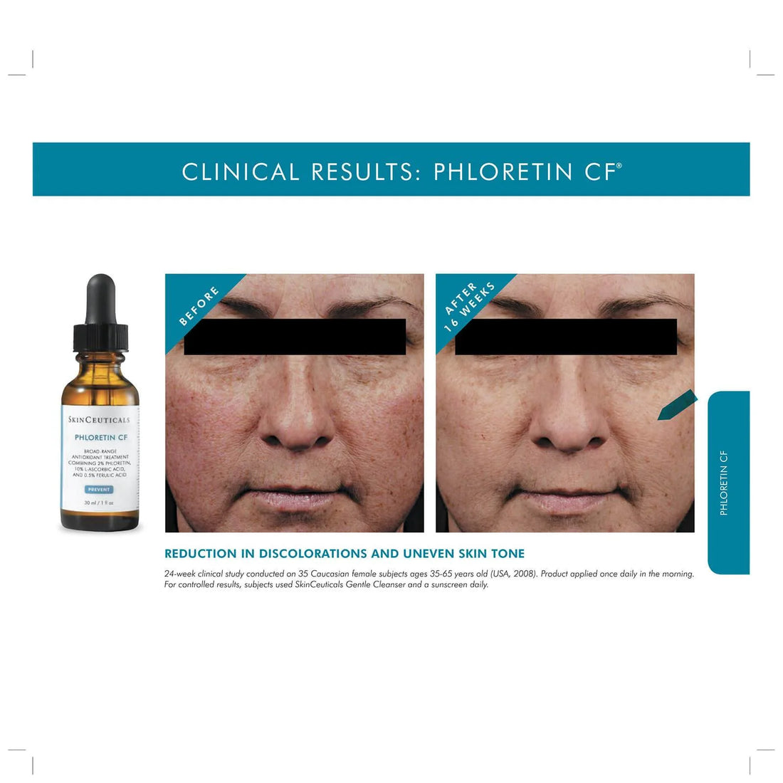 Phloretin CF - Skinceuticals - MELISSA FERGUSON - Before and After