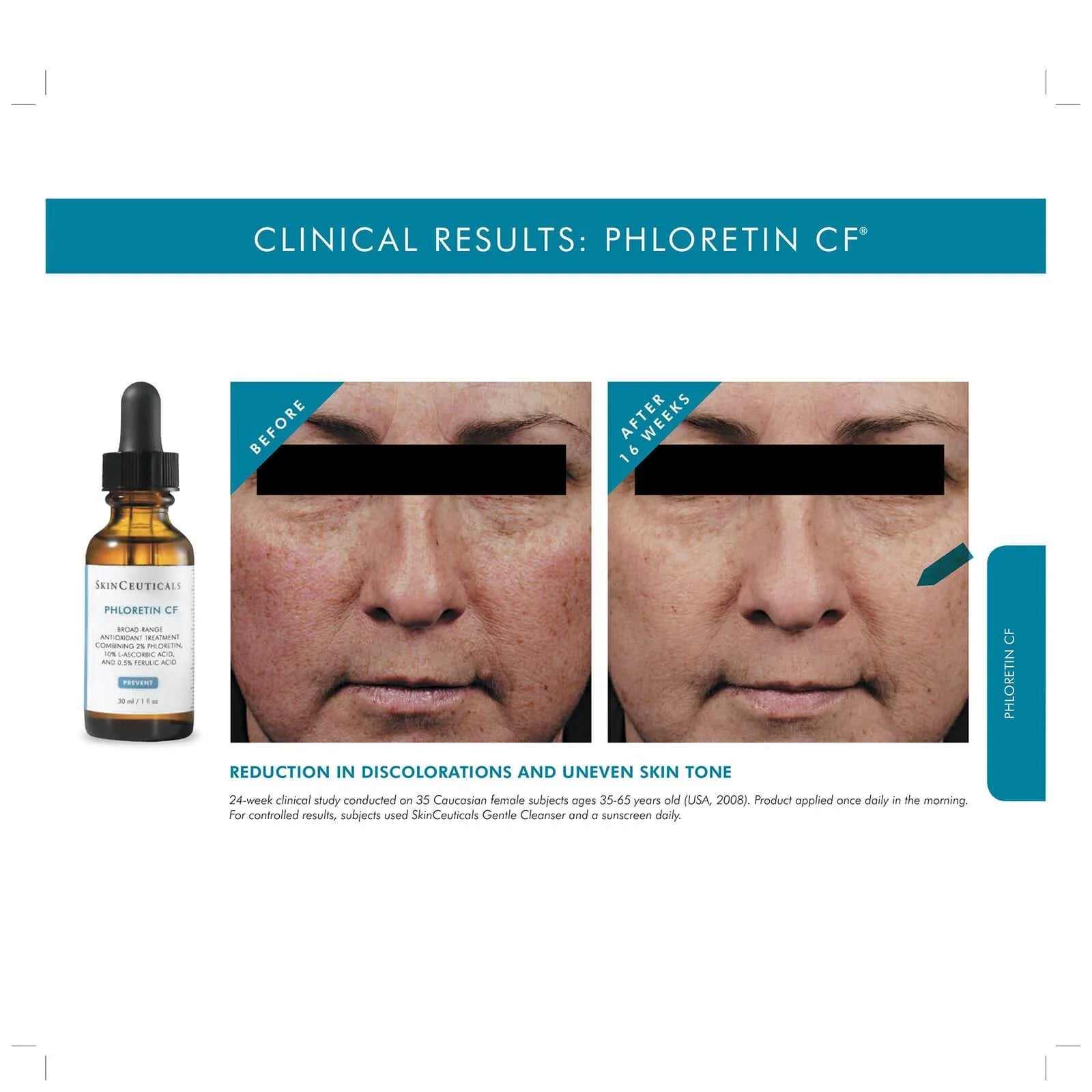 Phloretin CF - Skinceuticals - MELISSA FERGUSON - Before and After