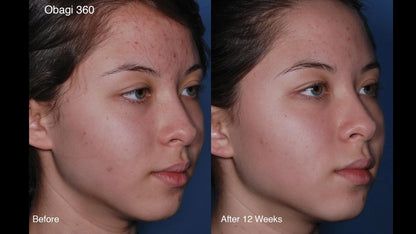 CLENZIderm Daily Foaming Cleanser