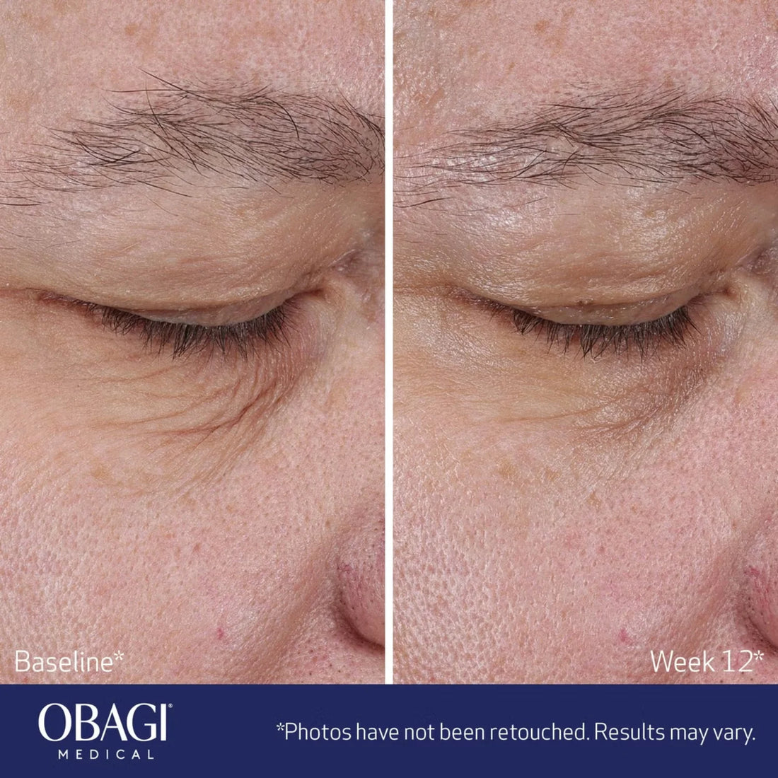 ELASTIderm Lift Up & Sculpt Facial Moisturizer