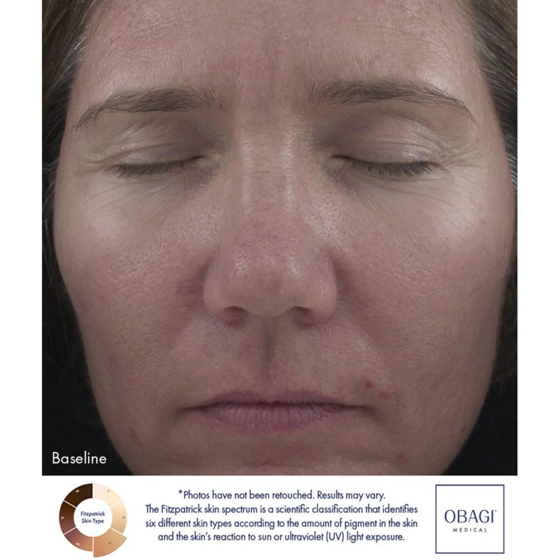 Retinol 1.0 Cream