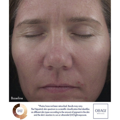 Retinol 1.0 Cream
